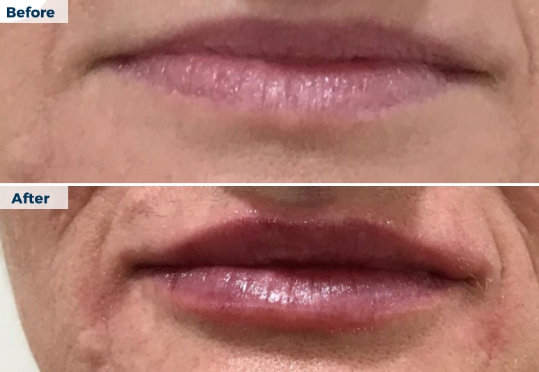 Skin Repair Skin Cancer Centre in Townsville, Queensland